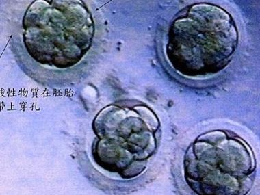 2026三门峡试管助孕医院排名分析！大龄女性做试管的费用是多少？